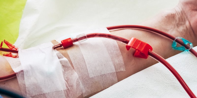 Angiologo para colocar fistula de hemodialisis Queretaro