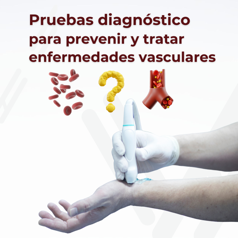 Estudios para mala circulacion Queretaro