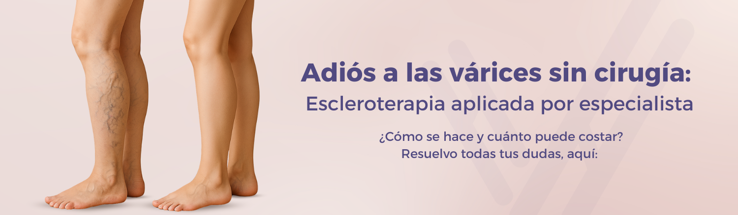 Especialista en escleroterapia Queretaro