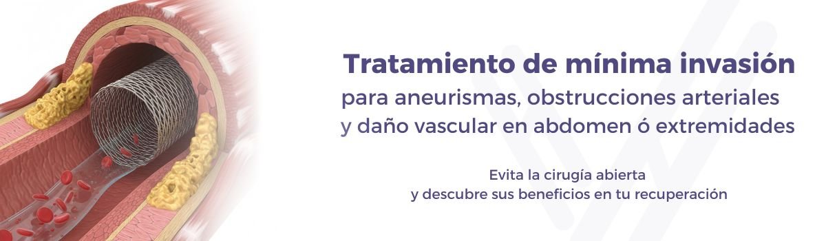 Cirujanos endovasculares Queretaro